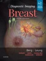 Diagnostic Imaging: Breast - Berg