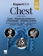 ExpertDDx: Chest - Carter