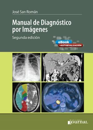 Manual de Diagnóstico por Imágenes - San Roman