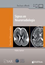 Signos en Neurorradiología + ebook - Sartori