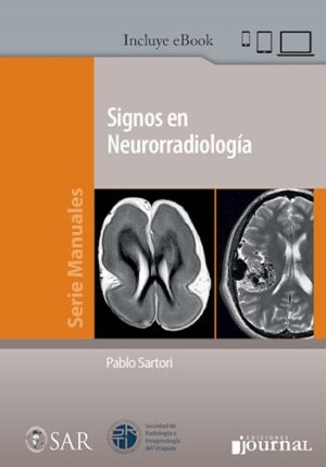 Signos en Neurorradiología + ebook - Sartori