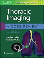 Thoracic Imaging: A Core Review