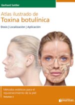 Atlas ilustrado de Toxina botulínica - Sattler
