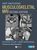 Musculoskeletal MRI Second Edition - Saifuddin
