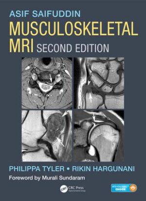 Musculoskeletal MRI Second Edition - Saifuddin