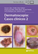 Dermatoscopia: Casos clínicos 2 - Cabo