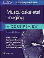 Musculoskeletal Imaging: A Core Review