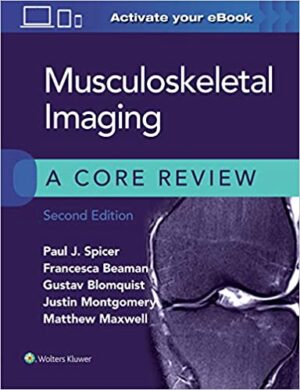 Musculoskeletal Imaging: A Core Review