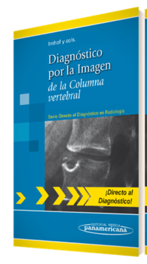 Diagnóstico por la Imagen de la Columna vertebral