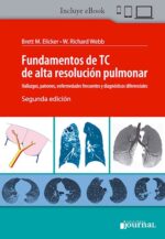 Fundamentos de TC de alta resolución pulmonar - Elicker