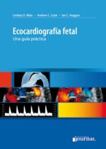 Ecocardiografía fetal - Allan