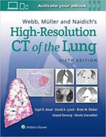 WMN High-Resolution CT of the Lung - Desai