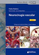 Neurocirugía vascular - Rubino
