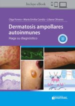 Dermatosis ampollares autoinmunes - Forero