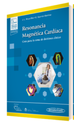 Resonancia magnética cardíaca