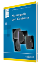 Mamografía con Contraste - Prieto