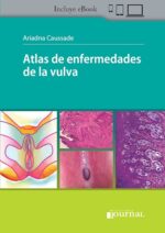 Atlas de enfermedades de la vulva - Caussade