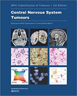 WHO Classification of Tumours, Central Nervous System