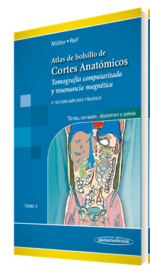 Atlas de Bolsillo de Cortes Anatómicos Tomo 2. Tomografía computarizada y resonancia magnética: tórax, corazón, abdomen y pelvis - Moller