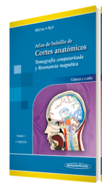 Atlas de Bolsillo de Cortes Anatómicos Tomo 1. Tomografía computarizada y resonancia magnética: cabeza y cuello - Moller
