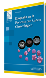 Ecografía en la Paciente con Cáncer Ginecológico - Alcazar