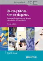 Arcuri Plasma y fibrina
