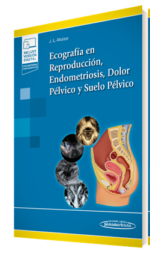 Alcazar ecog rafia en reproduccion