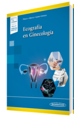 Ecografía en Ginecología