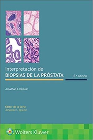 Interpretación de Biopsias de la Próstata