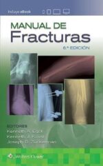 Manual De Fracturas - Egol