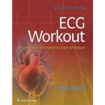 ECG Workout Exercises in Arrhythmia Interpretation - Huff