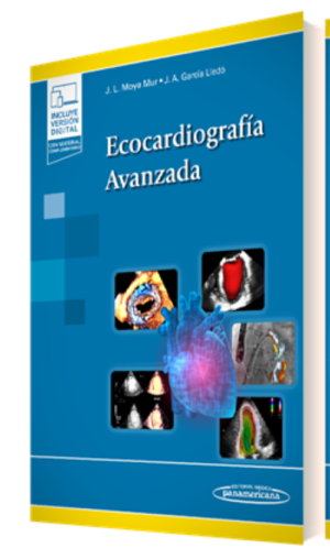 Ecocardiografía Avanzada - Moya