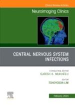 Central Nervous System Infections