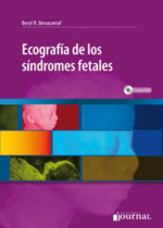 Benacerraf Ecografía de los síndromes fetales