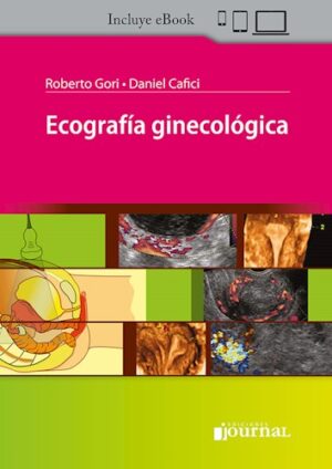 Ecografía ginecológica - Gori