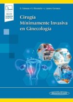 Cabezas Cirugía Mínimamente Invasiva en Ginecología