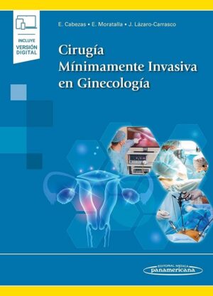 Cabezas Cirugía Mínimamente Invasiva en Ginecología