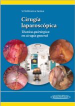 Schlottmann cirugía laparoscópica