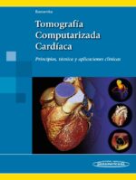 Bastarrika Tomografía Computarizada Cardíaca