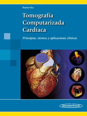 Bastarrika Tomografía Computarizada Cardíaca