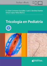 Tricología en Pediatría