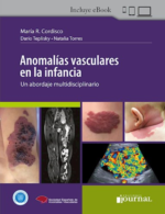 Anomalías Vasculares en la Infancia