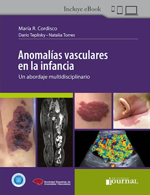 Anomalías Vasculares en la Infancia
