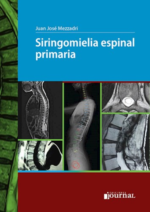 Mezzadri Siringomielia espinal primaria
