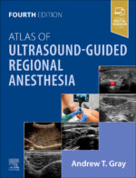 Atlas of Ultrasound-Guided Regional Anesthesia