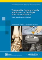 Serme Tomografía Computarizada Multicorte en Patología Musculoesquelética