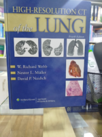 Webb High-Resolution CT of the Lung