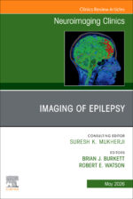 Watson Imaging of Epilepsy An Issue of Neuroimaging Clinics