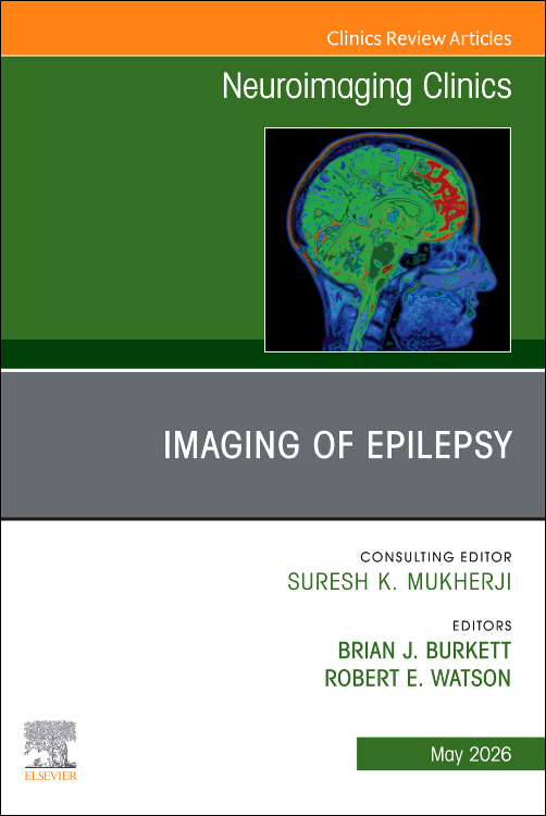 Watson Imaging of Epilepsy An Issue of Neuroimaging Clinics