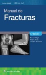 Egol Manual De Fracturas 7ed